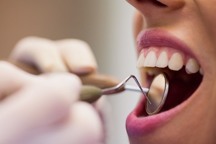 Come curare i denti se non si hanno sold