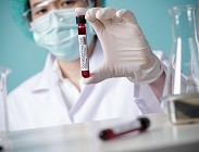 test coronavirus Robbio Importanti rivelazioni
